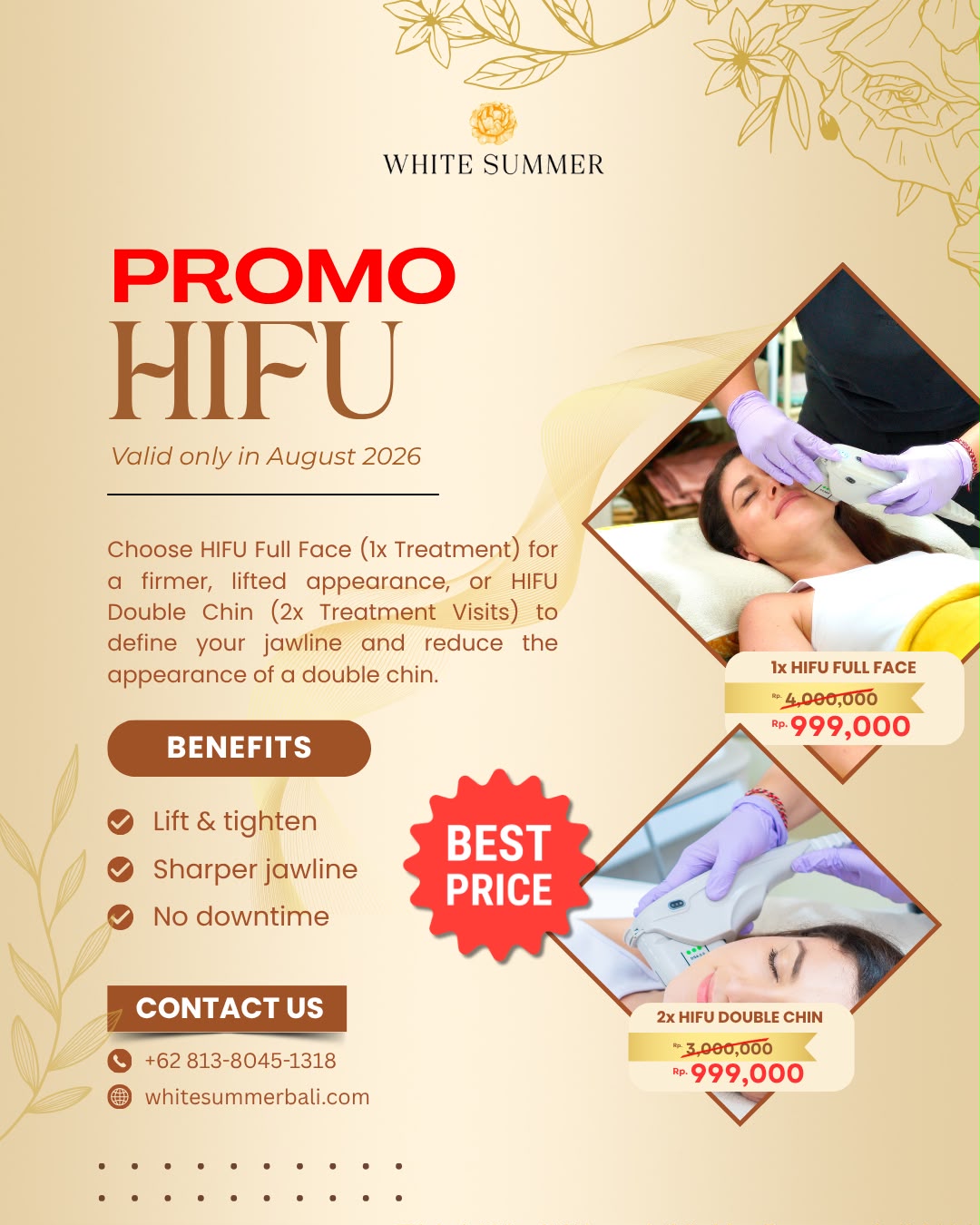 promo hifu in bali